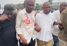 RDC : Martin Fayulu blessé lors d’une manifestation de l’opposition à Kinshasa
